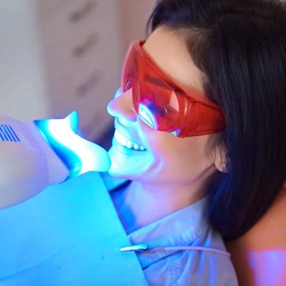 teeth whitening in Mt. Brydges