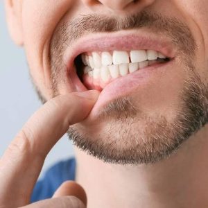 gum disease treatment in Mt. Brydges